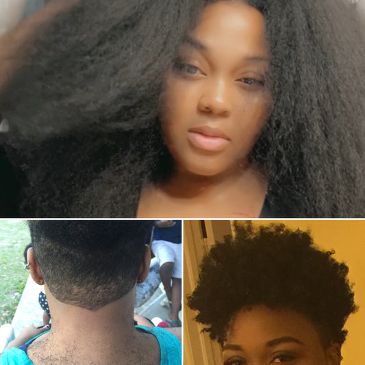 Hair Growth Serum - Scalp Stimulator